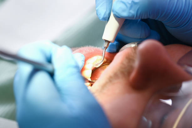 Best Pediatric Emergency Dentist in San Rlos, CA