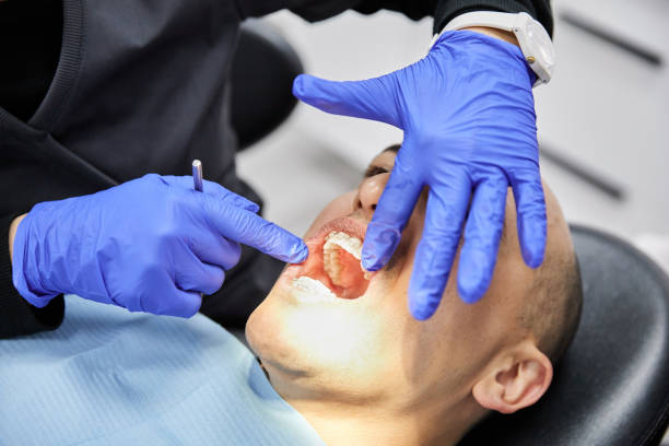 Best Emergency Gum Treatment in San Rlos, CA